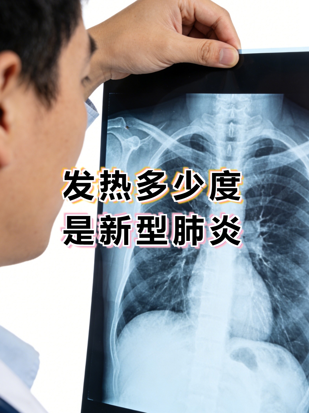 「郑州新型肺炎」〃河南郑州新型肺炎-第2张图片