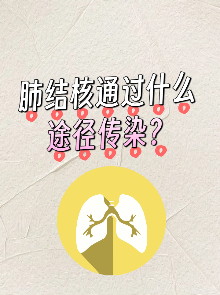 次密接者最新隔离规定〃密接肺结核患者后多久筛查一次-第2张图片