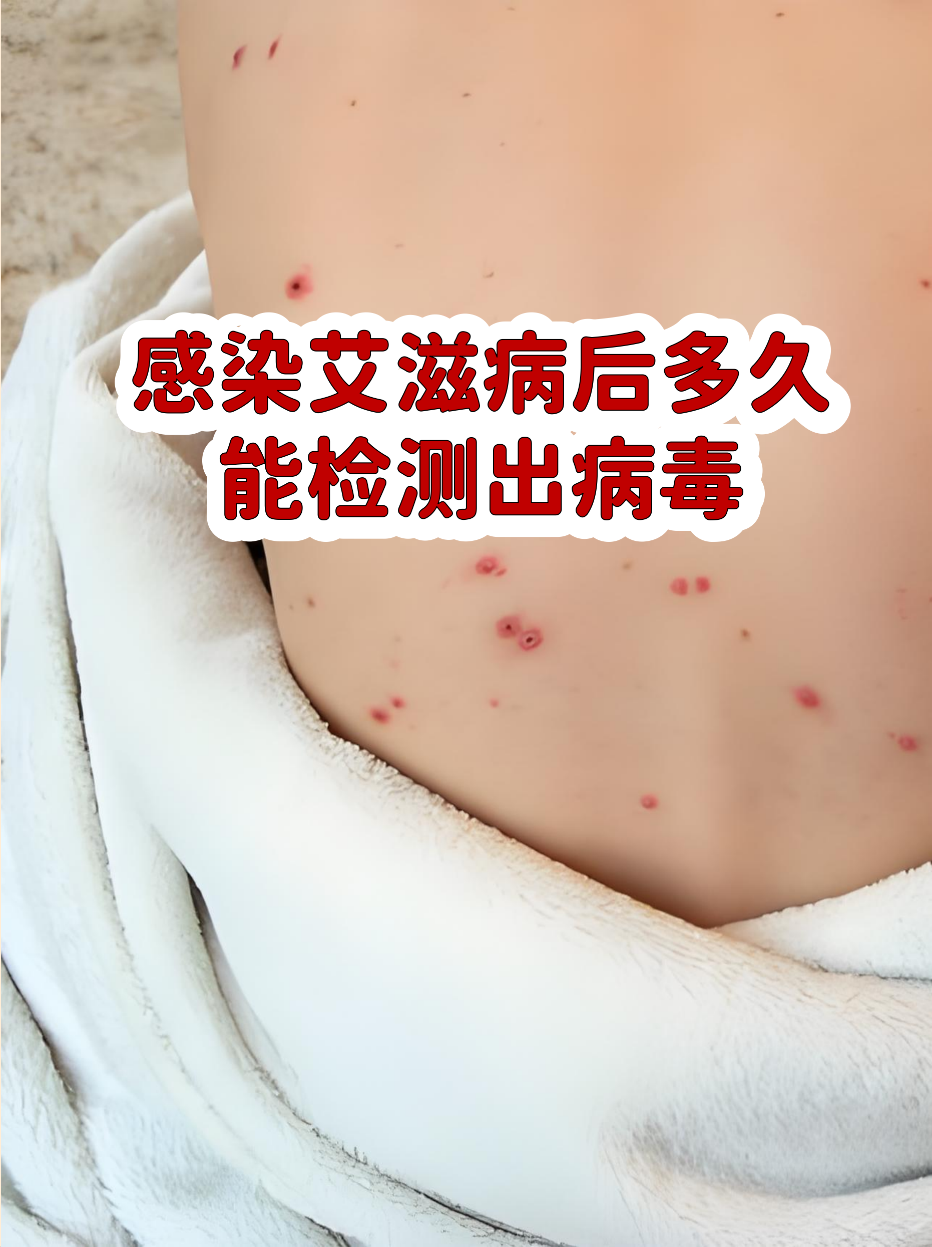【广州番禺报告一例阳性感染者/广州番禺艾滋病检测】-第2张图片