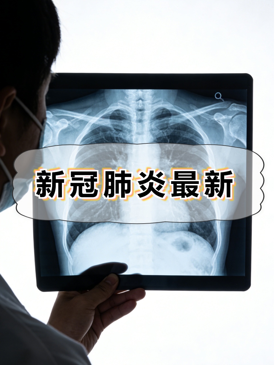 “北京新冠重症清零” 北京新冠疫情启始终结？-第1张图片
